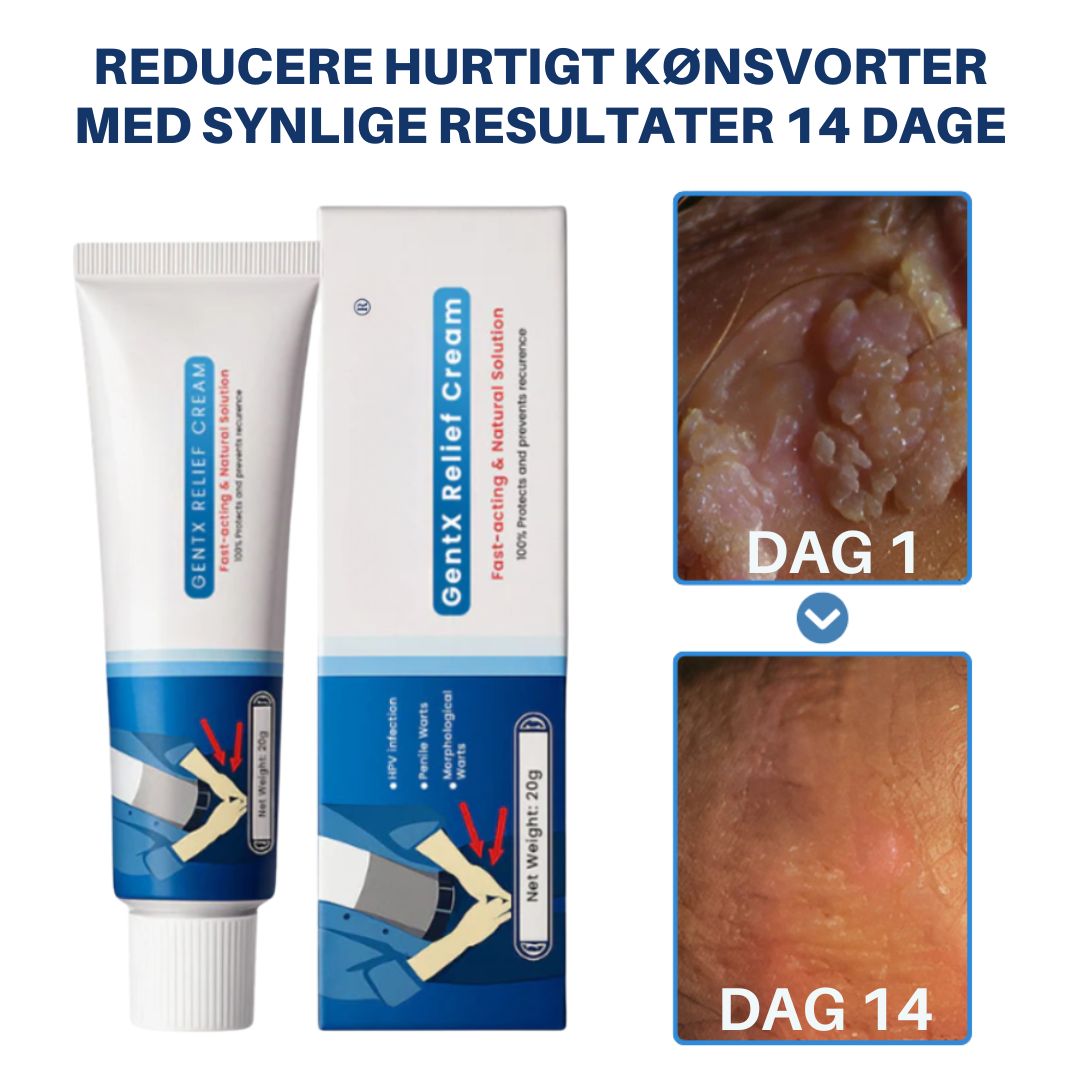 WartAway™ – Genitalvorte Lindre Creme