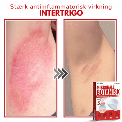 SkinLift™ – Botanisk Hudmærkefjerner