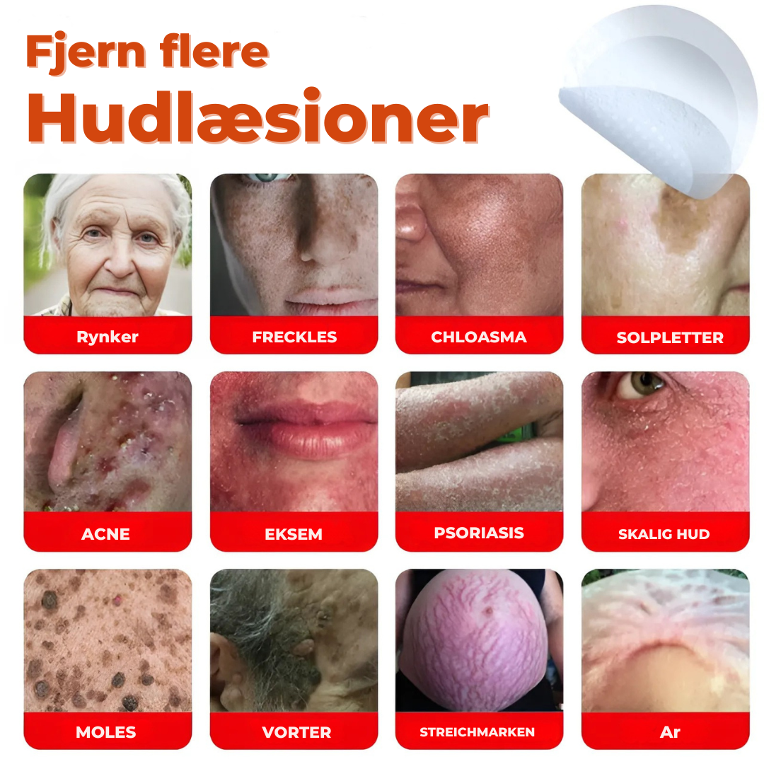 SkinLift™ – Botanisk Hudmærkefjerner