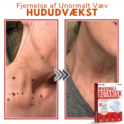 SkinLift™ – Botanisk Hudmærkefjerner
