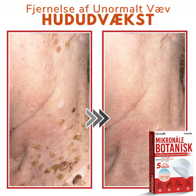 SkinLift™ – Botanisk Hudmærkefjerner