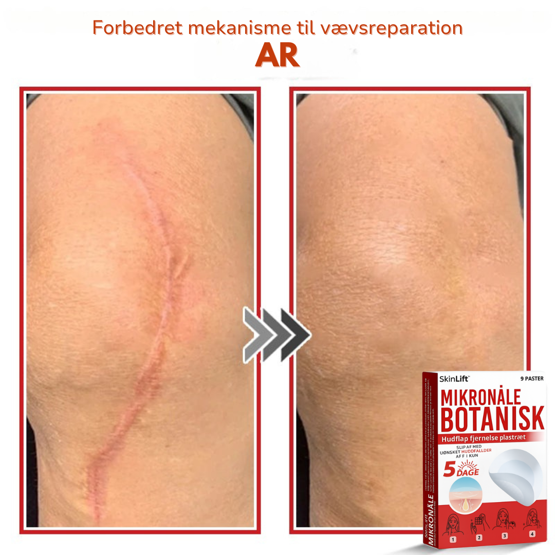 SkinLift™ – Botanisk Hudmærkefjerner