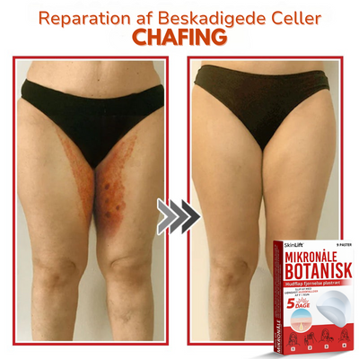SkinLift™ – Botanisk Hudmærkefjerner