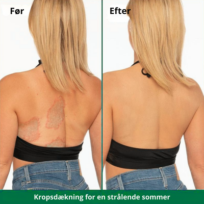 SkinLuxe™ – Øjeblikkelig Kropsdækning Perfector