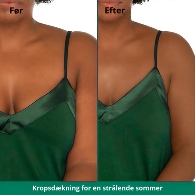 SkinLuxe™ – Øjeblikkelig Kropsdækning Perfector