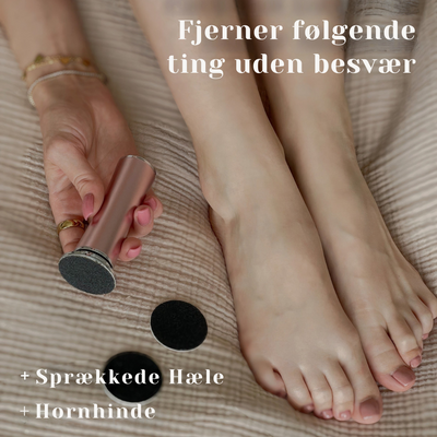 SootheSteps™ – Løsning til Reparation af Sprukne Hæle