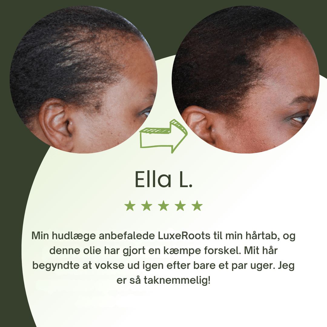LuxeRoots™ - Ultimativ Hårvækstolie