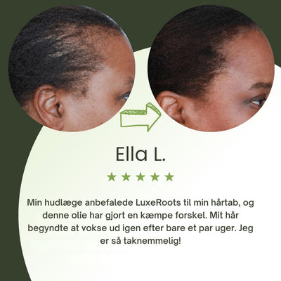 LuxeRoots™ - Ultimativ Hårvækstolie