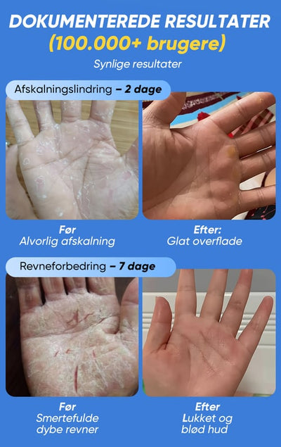 Soothera™ – Dybt Reparerende Fodcreme
