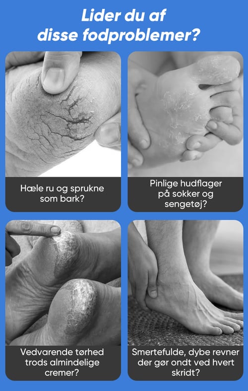 Soothera™ – Dybt Reparerende Fodcreme