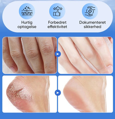 Soothera™ – Dybt Reparerende Fodcreme