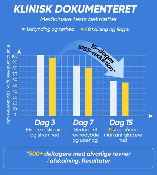 Soothera™ – Dybt Reparerende Fodcreme
